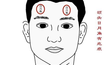 日月角隆起|面相图解：日月角，日月角隆起，日角与月角